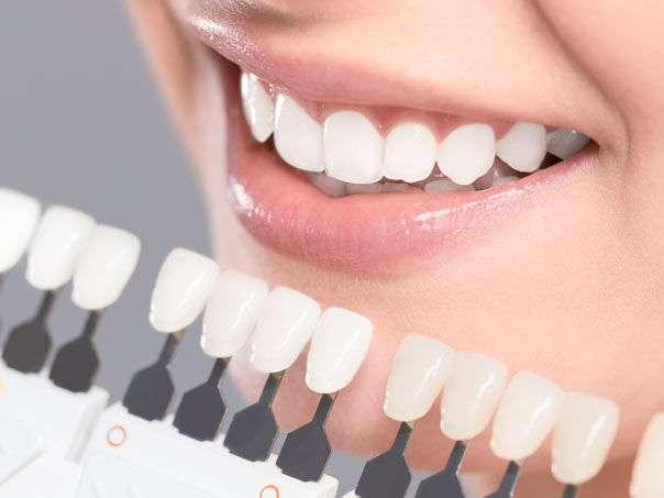 Teeth Whitening colours